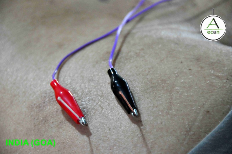 En nuestros tratamientos la electro es muy común